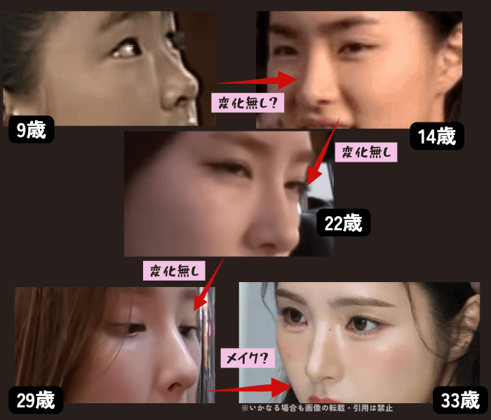 韓国女優シンセギョンの鼻の変化について時系列検証画像
以下5枚の画像

9歳（左上画像）
14歳（右上画像）
22歳（中央画像）
29歳（左下画像）
33歳（右下画像）

9歳から14歳は、成長過程が著しいこともあり変化は当然で整形の有無はわかりにくい。
しかし9歳でも整った鼻の形をしていることが画像でわかる。
14歳、22歳、29歳と鼻の形に変化無し。
33歳の画像は鼻の高さが強調されて高く見えるがシャドウを入れたメイクの影響と思われる。